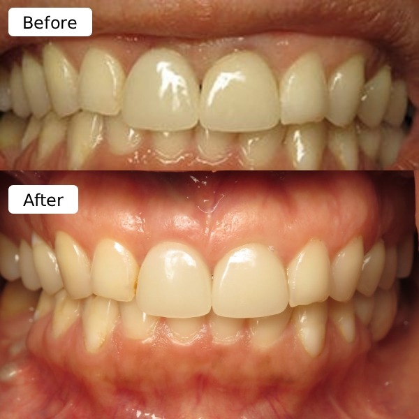 Dental chart sample