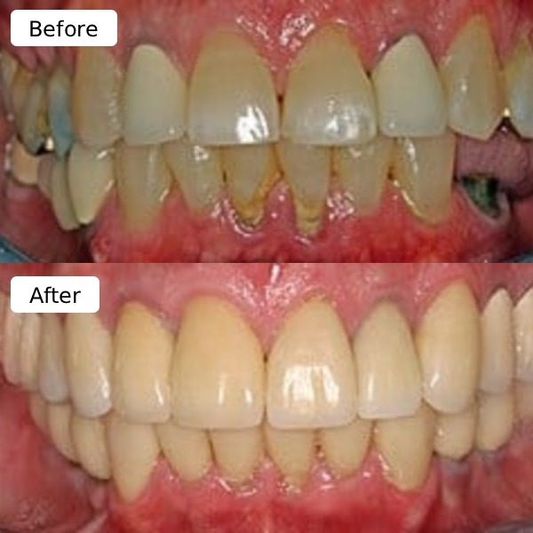 Restorative dentistry result